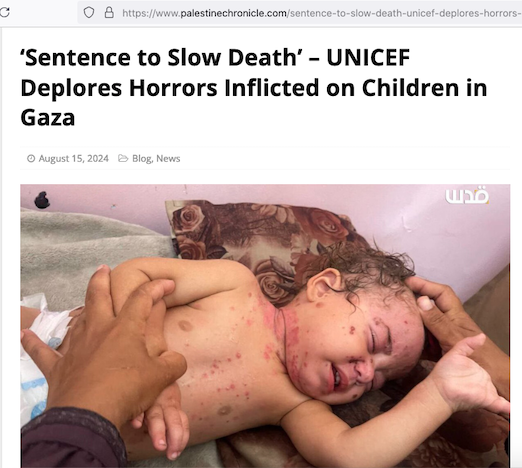 Babies and Children in Gaza Sentenced To A Slow Death.png